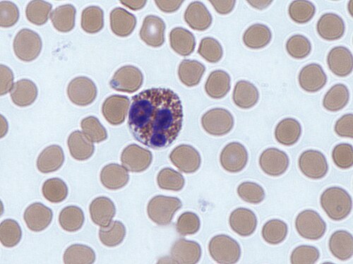 Eosinophil among red blood cells, Giemsa stain. The bright orange-red cytoplasmic granules are visible against the pale erythrocytes.