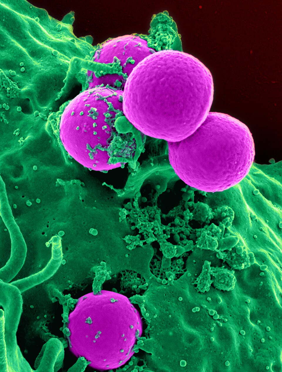 Scanning electron micrograph of a human neutrophil (blue) engulfing MRSA bacteria (yellow). The cell extends pseudopods around the bacteria in a classic phagocytic embrace.