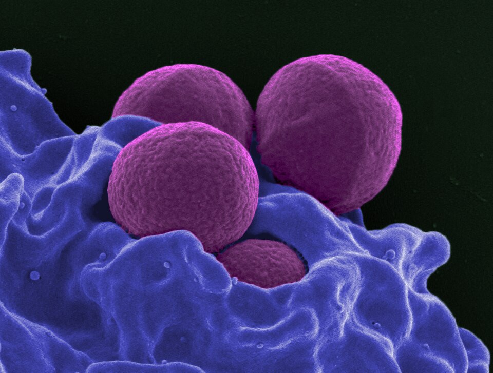 Scanning electron micrograph of a neutrophil (orange-brown) with MRSA bacteria (purple). A second image from the NIH SEM series on neutrophil-pathogen interaction.