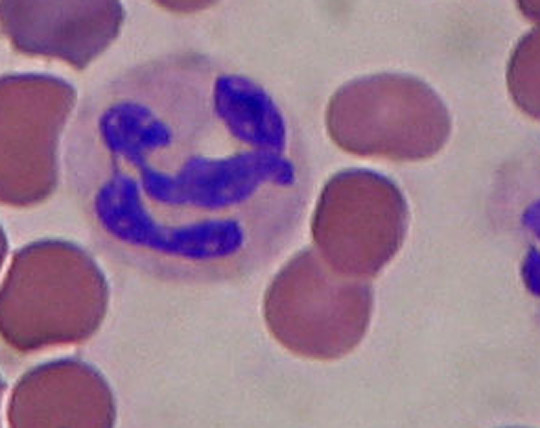 Neutrophil in a peripheral blood smear showing the characteristic segmented nucleus with 3 to 5 lobes.