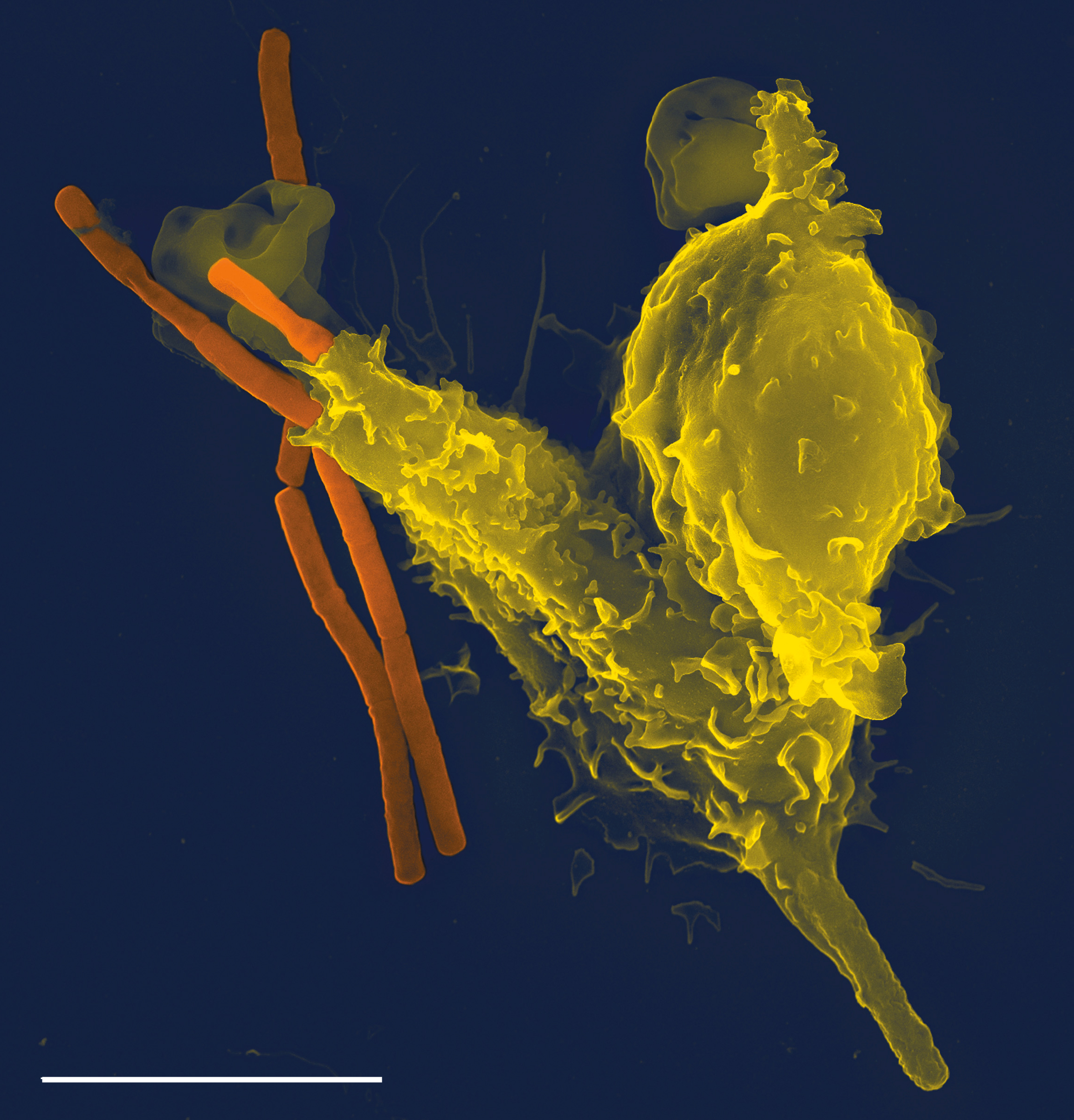 Scanning electron micrograph of a neutrophil (orange) engaging a Bacillus anthracis chain (green). Taken by Volker Brinkmann, the scientist who discovered neutrophil extracellular traps.