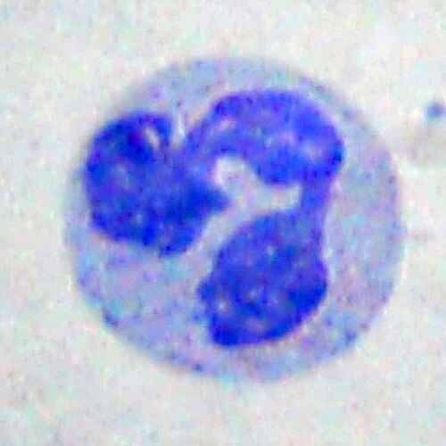 Neutrophil in a peripheral blood smear, Wright stain. The multilobed nucleus and pale cytoplasm are characteristic of the circulating PMN.